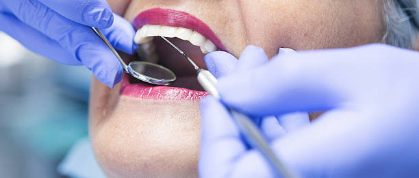 Best Walk-In Dentist Near Me  in Burley, WA
